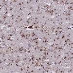 ADAMTS13 Antibody in Immunohistochemistry (Paraffin) (IHC (P))