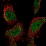 SUMO2 Polyclonal Antibody