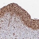 SUMO2 Antibody in Immunohistochemistry (Paraffin) (IHC (P))