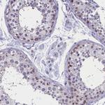 AMID Polyclonal Antibody