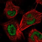 SAP30BP Polyclonal Antibody