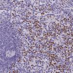 IL17B Antibody in Immunohistochemistry (Paraffin) (IHC (P))
