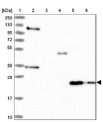 IL17B Antibody in Western Blot (WB)