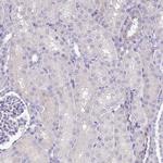 SFTPA1 Antibody in Immunohistochemistry (Paraffin) (IHC (P))