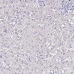 SFTPA1 Antibody in Immunohistochemistry (Paraffin) (IHC (P))