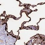 SFTPA1 Antibody in Immunohistochemistry (Paraffin) (IHC (P))