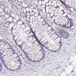 SFTPA1 Antibody in Immunohistochemistry (Paraffin) (IHC (P))