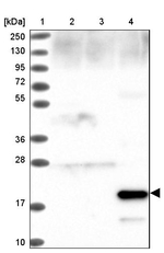 SFTPA1 Antibody in Western Blot (WB)