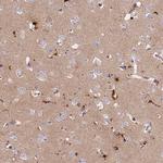 PrP Antibody in Immunohistochemistry (Paraffin) (IHC (P))