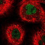 THOC3 Polyclonal Antibody