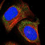 ADAMTS15 Polyclonal Antibody