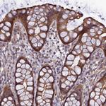 ADAMTS15 Antibody in Immunohistochemistry (Paraffin) (IHC (P))