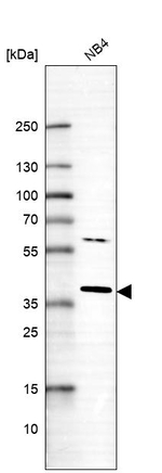 RNF166 Antibody in Western Blot (WB)