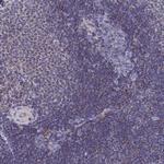 CCRL2 Polyclonal Antibody