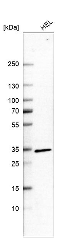 CCRL2 Antibody in Western Blot (WB)