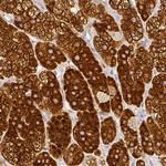 HSD3B1 Polyclonal Antibody