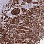 PDE4A Polyclonal Antibody