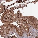 ORP1 Polyclonal Antibody