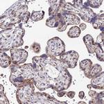 TRIM24 Antibody in Immunohistochemistry (Paraffin) (IHC (P))