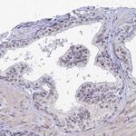 TRIM24 Antibody in Immunohistochemistry (Paraffin) (IHC (P))