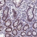 TRIM24 Antibody in Immunohistochemistry (Paraffin) (IHC (P))