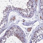 TRIM24 Antibody in Immunohistochemistry (Paraffin) (IHC (P))