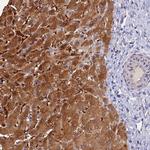 FZR1 Antibody in Immunohistochemistry (Paraffin) (IHC (P))