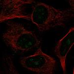 CIRH1A Antibody in Immunocytochemistry (ICC/IF)