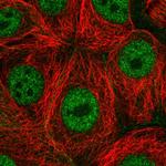 PAF1 Polyclonal Antibody