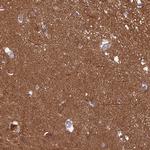 RanBP16 Polyclonal Antibody