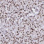 Histone H1.1 Antibody in Immunohistochemistry (Paraffin) (IHC (P))