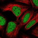 ZBTB22 Polyclonal Antibody