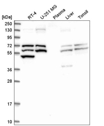 TrxR1 Antibody in Western Blot (WB)