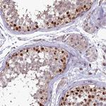 TSPYL2 Antibody in Immunohistochemistry (Paraffin) (IHC (P))