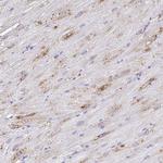 A1BG Antibody in Immunohistochemistry (Paraffin) (IHC (P))