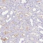 A1BG Antibody in Immunohistochemistry (Paraffin) (IHC (P))