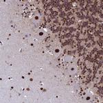 SART3 Polyclonal Antibody