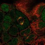 SP6 Antibody in Immunocytochemistry (ICC/IF)