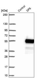 SP6 Antibody in Western Blot (WB)