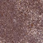 CGBP Antibody in Immunohistochemistry (Paraffin) (IHC (P))