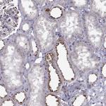 CLN2 Antibody in Immunohistochemistry (Paraffin) (IHC (P))