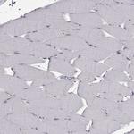 CLN2 Antibody in Immunohistochemistry (Paraffin) (IHC (P))