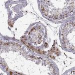 CLN2 Antibody in Immunohistochemistry (Paraffin) (IHC (P))