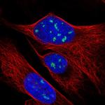 RPP38 Polyclonal Antibody