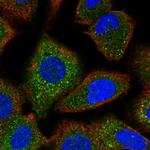 FANCG Antibody in Immunocytochemistry (ICC/IF)
