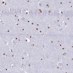 RYK Polyclonal Antibody