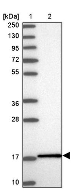 UBE2L3 Antibody in Western Blot (WB)