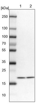 UBE2L3 Antibody in Western Blot (WB)