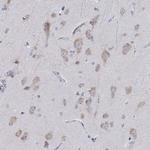 Lass1 Antibody in Immunohistochemistry (Paraffin) (IHC (P))