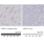 Lass1 Antibody in Immunohistochemistry (Paraffin) (IHC (P))
